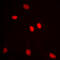 Adenosine Deaminase RNA Specific B1 antibody, GTX54916, GeneTex, Immunocytochemistry image 