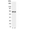 Solute Carrier Family 1 Member 3 antibody, R31307, NSJ Bioreagents, Western Blot image 