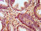 Potassium channel subfamily T member 1 antibody, LS-C674199, Lifespan Biosciences, Immunohistochemistry paraffin image 