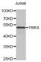 Probable fibrosin-1 long transcript protein antibody, abx003747, Abbexa, Western Blot image 