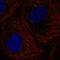 DEAD-Box Helicase 6 antibody, NBP1-83249, Novus Biologicals, Immunofluorescence image 