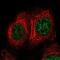 Transforming Growth Factor Beta Regulator 1 antibody, PA5-65962, Invitrogen Antibodies, Immunofluorescence image 