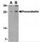 CER antibody, LS-B478, Lifespan Biosciences, Western Blot image 