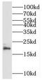 Mitochondrial Ribosomal Protein L49 antibody, FNab05337, FineTest, Western Blot image 