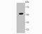 PEAK Family Member 3 antibody, NBP2-67196, Novus Biologicals, Western Blot image 