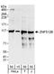 Zinc Finger Protein 512B antibody, A303-234A, Bethyl Labs, Western Blot image 