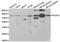 Forkhead Box O1 antibody, STJ23704, St John