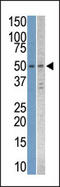 STK38L antibody, AP14490PU-N, Origene, Western Blot image 