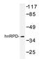 Heterogeneous nuclear ribonucleoprotein D0 antibody, AP20246PU-N, Origene, Western Blot image 