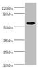 Epoxide Hydrolase 1 antibody, A56373-100, Epigentek, Western Blot image 