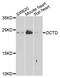 DEAD-Box Helicase 1 antibody, LS-C334363, Lifespan Biosciences, Western Blot image 