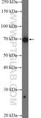 Probable ATP-dependent RNA helicase DDX5 antibody, 26385-1-AP, Proteintech Group, Western Blot image 