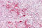 ETS Variant 5 antibody, 27-534, ProSci, Western Blot image 