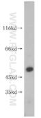 Fanconi anemia group C protein antibody, 16973-1-AP, Proteintech Group, Western Blot image 