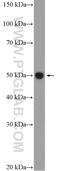 Fascin Actin-Bundling Protein 1 antibody, 14384-1-AP, Proteintech Group, Western Blot image 