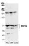 SRP Receptor Subunit Alpha antibody, A305-140A, Bethyl Labs, Western Blot image 
