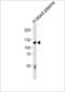 Complement C6 antibody, LS-C168160, Lifespan Biosciences, Western Blot image 