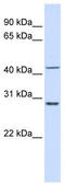 Ribosomal Protein L3 antibody, TA346542, Origene, Western Blot image 