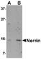 Norrin Cystine Knot Growth Factor NDP antibody, orb75178, Biorbyt, Western Blot image 