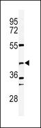 DNA Fragmentation Factor Subunit Beta antibody, LS-C167374, Lifespan Biosciences, Western Blot image 
