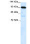 Lysine Methyltransferase 5B antibody, 28-129, ProSci, Enzyme Linked Immunosorbent Assay image 