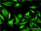 LARP antibody, LS-C197051, Lifespan Biosciences, Immunofluorescence image 