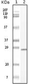 c-Kit antibody, 32-138, ProSci, Western Blot image 