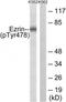 Ezrin antibody, TA326188, Origene, Western Blot image 