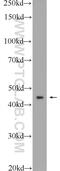 Homeobox protein Hox-A2 antibody, 25044-1-AP, Proteintech Group, Western Blot image 
