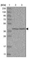 Uroporphyrinogen decarboxylase antibody, NBP1-89513, Novus Biologicals, Western Blot image 