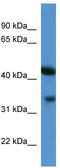 ArfGAP With Dual PH Domains 1 antibody, TA340145, Origene, Western Blot image 