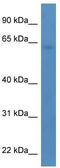 TBC1 Domain Family Member 10A antibody, TA342993, Origene, Western Blot image 