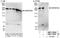 Small Nuclear Ribonucleoprotein U5 Subunit 200 antibody, NBP1-79037, Novus Biologicals, Western Blot image 