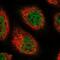 Chromosome 11 Open Reading Frame 49 antibody, PA5-59045, Invitrogen Antibodies, Immunofluorescence image 