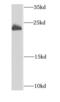 DCMP Deaminase antibody, FNab02273, FineTest, Western Blot image 