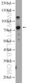 UV Stimulated Scaffold Protein A antibody, 25054-1-AP, Proteintech Group, Western Blot image 