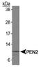 Presenilin Enhancer, Gamma-Secretase Subunit antibody, TA336624, Origene, Western Blot image 
