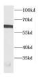 CBFA2/RUNX1 Partner Transcriptional Co-Repressor 3 antibody, FNab01316, FineTest, Western Blot image 