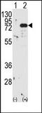 Protein kinase C beta type antibody, AP13543PU-N, Origene, Western Blot image 