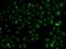 ANTXR Cell Adhesion Molecule 2 antibody, orb373413, Biorbyt, Immunocytochemistry image 