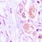 Fatty Acid Binding Protein 5 antibody, orb411630, Biorbyt, Immunohistochemistry paraffin image 