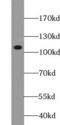 Ubiquitin-protein ligase E3C antibody, FNab09191, FineTest, Western Blot image 