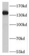 Stk antibody, FNab07384, FineTest, Western Blot image 