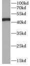 K20 antibody, FNab02212, FineTest, Western Blot image 