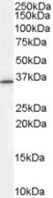 Ring Finger Protein 115 antibody, EB07140, Everest Biotech, Western Blot image 
