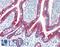 Villin 1 antibody, LS-B16167, Lifespan Biosciences, Immunohistochemistry paraffin image 