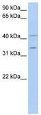 LIM And SH3 Protein 1 antibody, TA334408, Origene, Western Blot image 