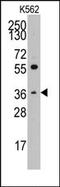 Thrombopoietin antibody, AP14198PU-N, Origene, Western Blot image 
