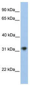 Carbohydrate Sulfotransferase 13 antibody, TA330984, Origene, Western Blot image 