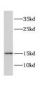 Cellular retinoic acid-binding protein 1 antibody, FNab01950, FineTest, Western Blot image 